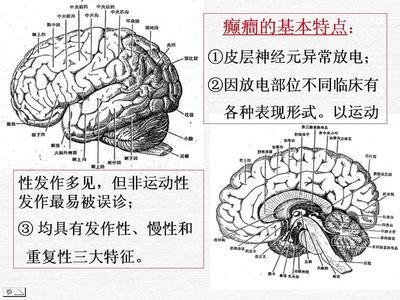 儿童癫痫发病特点有哪些